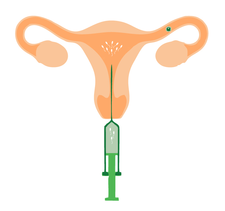 iui